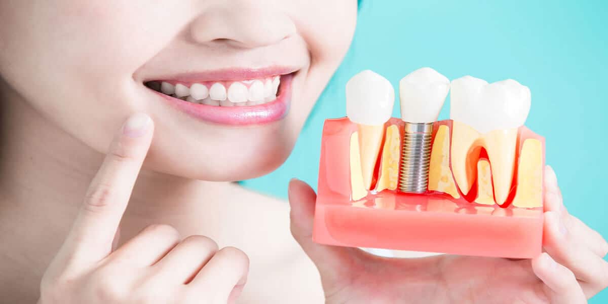 Dental implants benefits 600sep2018.jpg