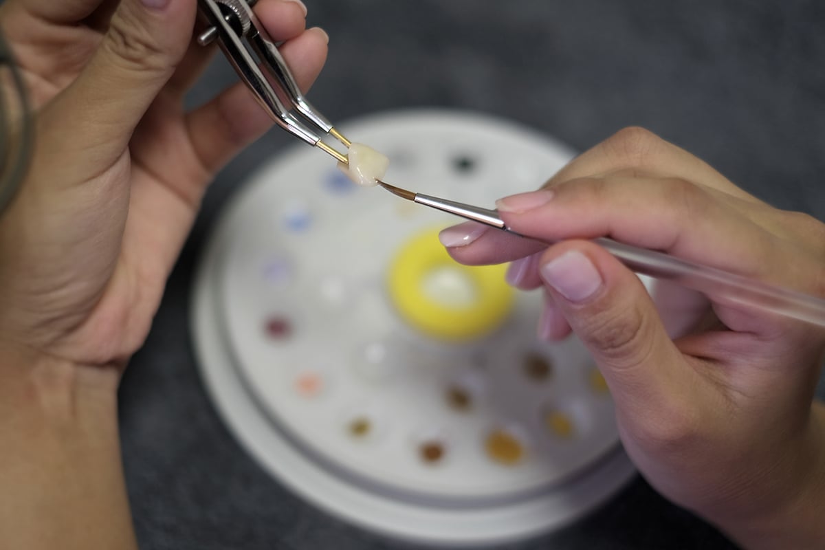 How accurate are cerec crowns fit material and longevity explained blog