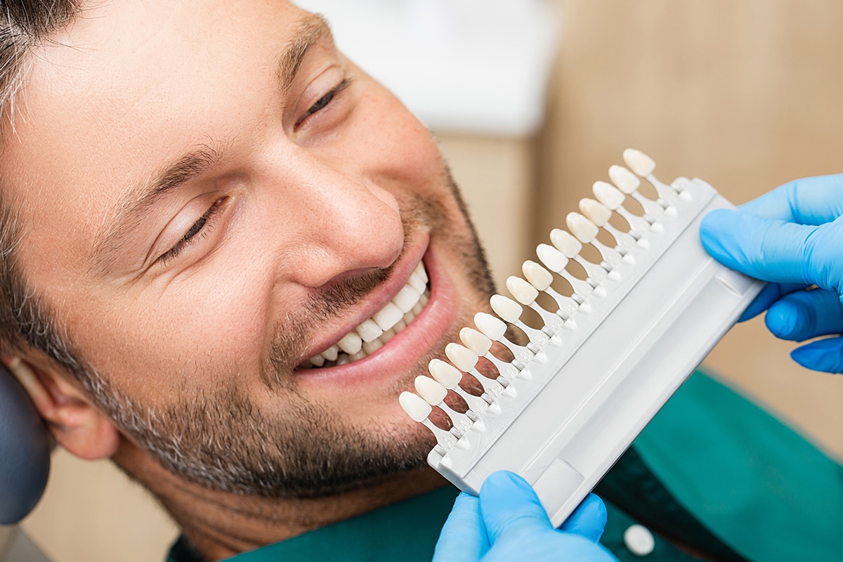 How much do veneers cost per tooth a helpful pricing guide blog