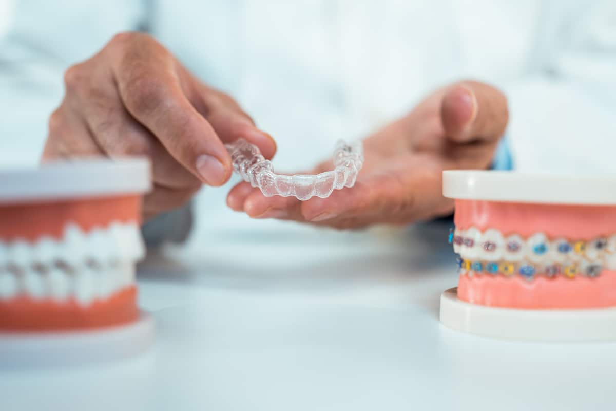 Invisalign vs braces which is better for adult teeth alignment blog